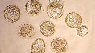 Pope Sticks up for Embryos